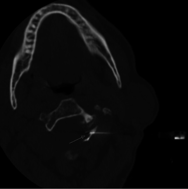FIG 3.