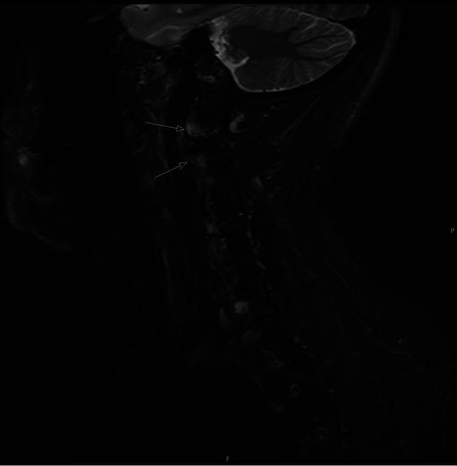 FIG 1.