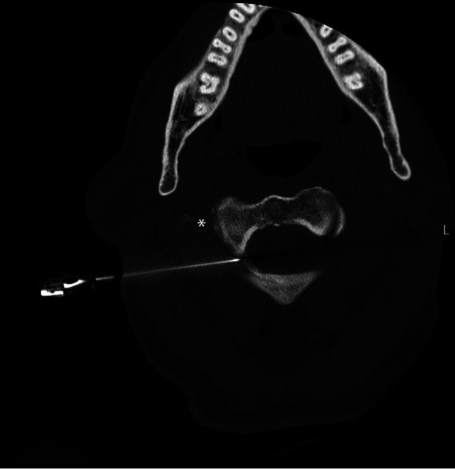 FIG 2.