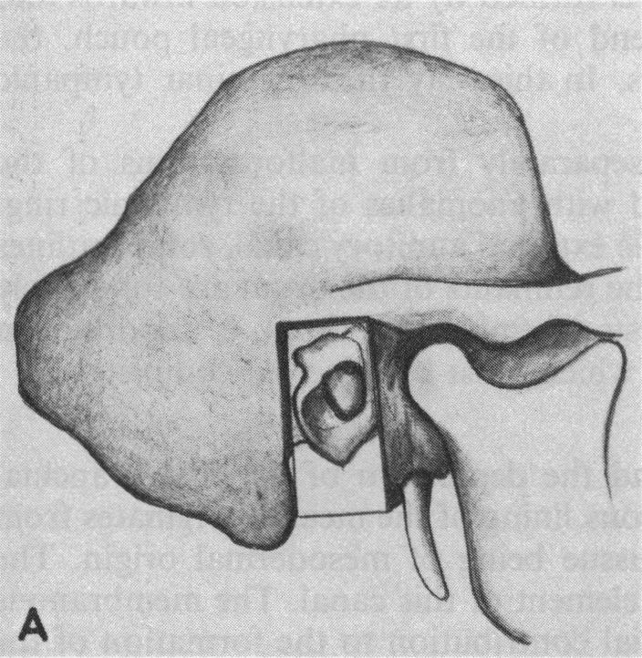 Figure 1. A