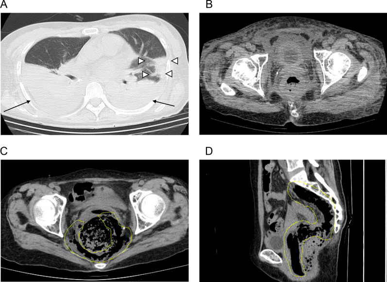 Fig. 1