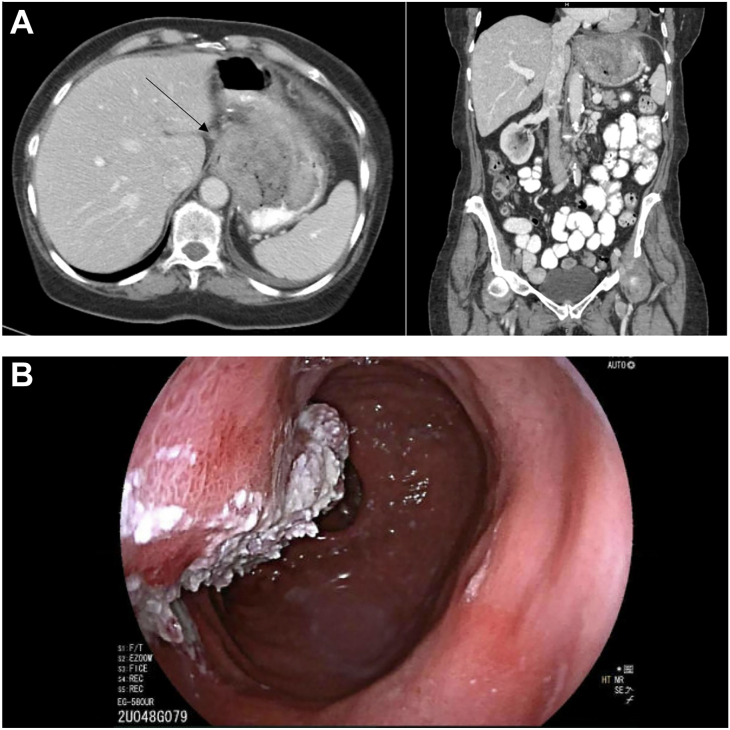 Figure 1