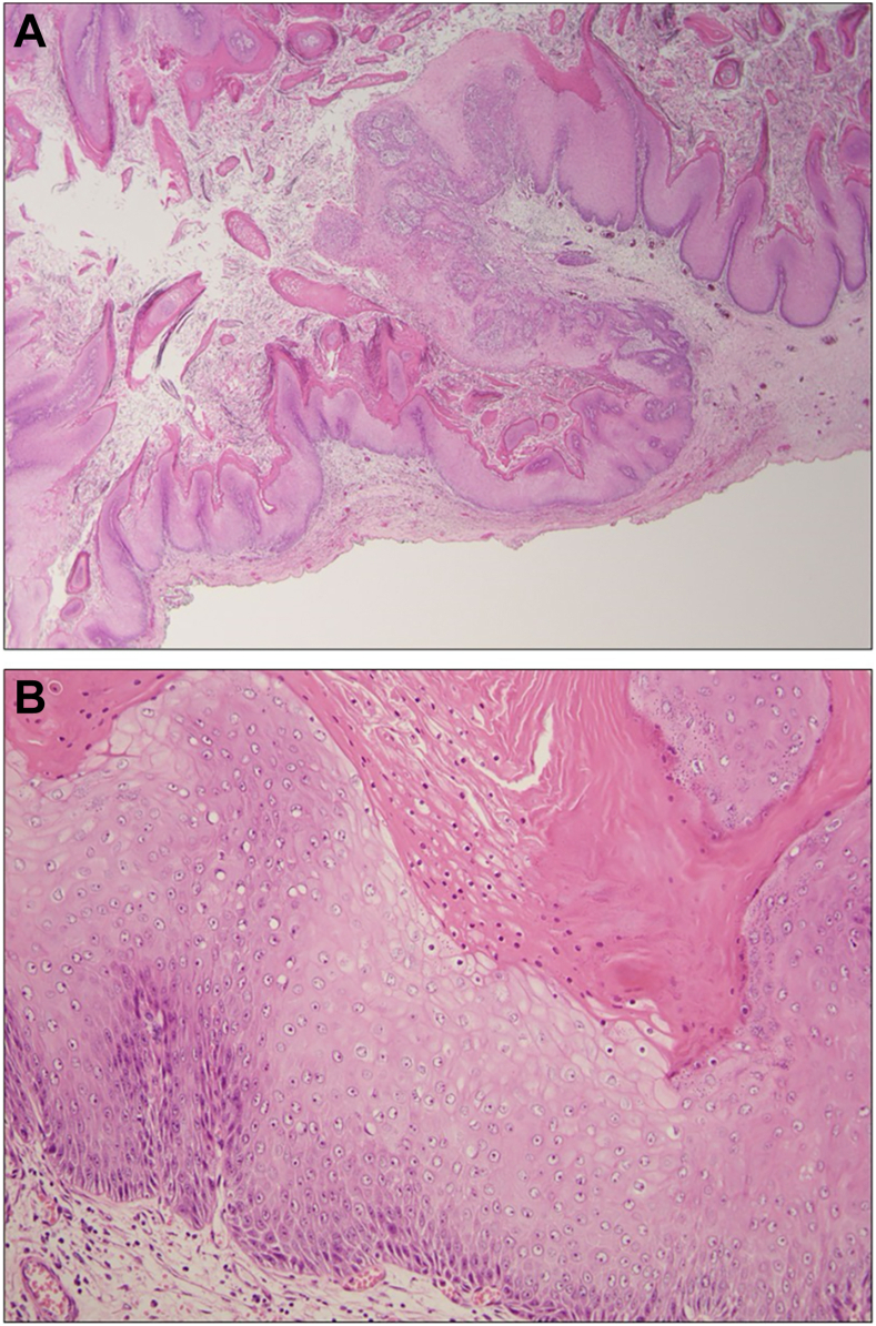 Figure 3