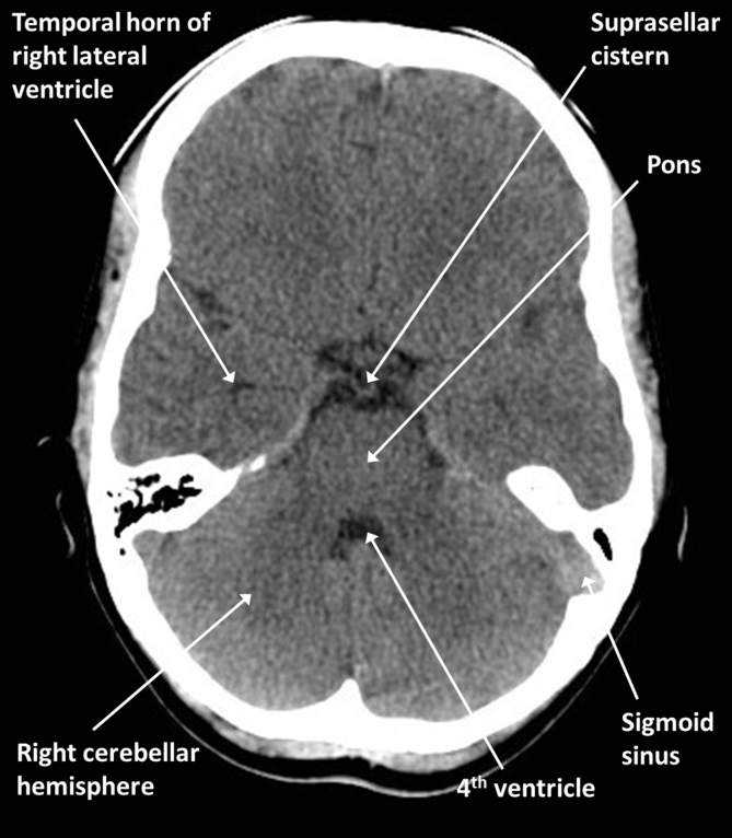 Fig 2