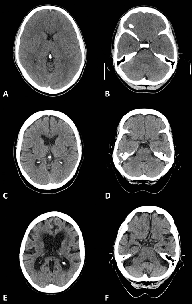 Fig 3