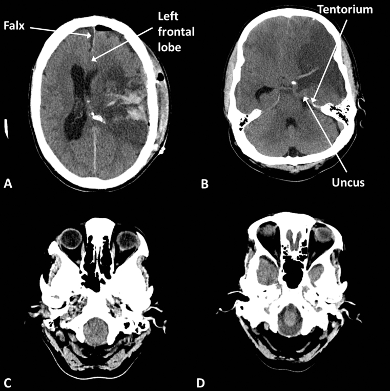 Fig 4