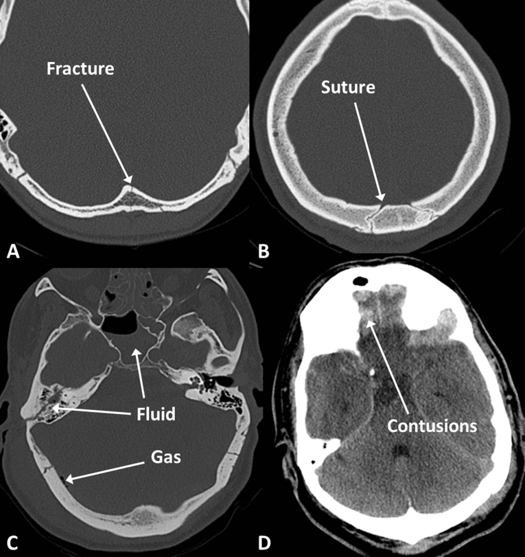 Fig 5