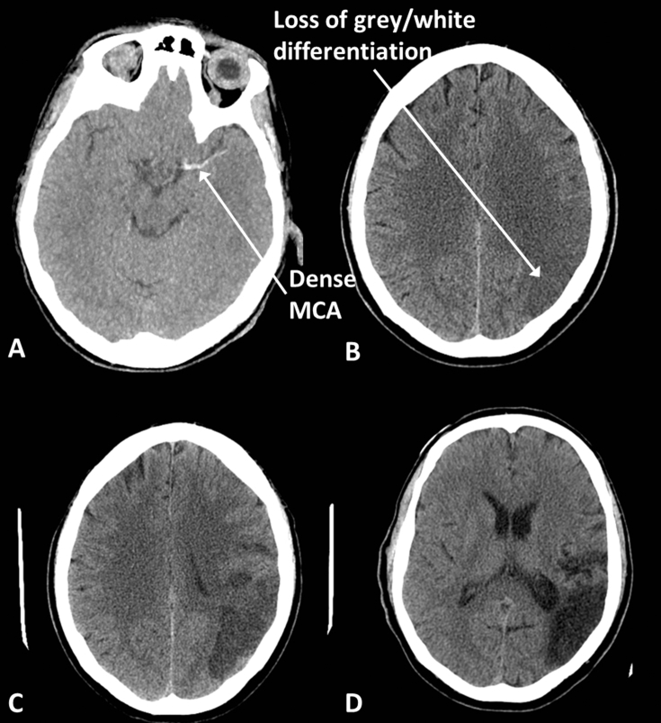 Fig 9