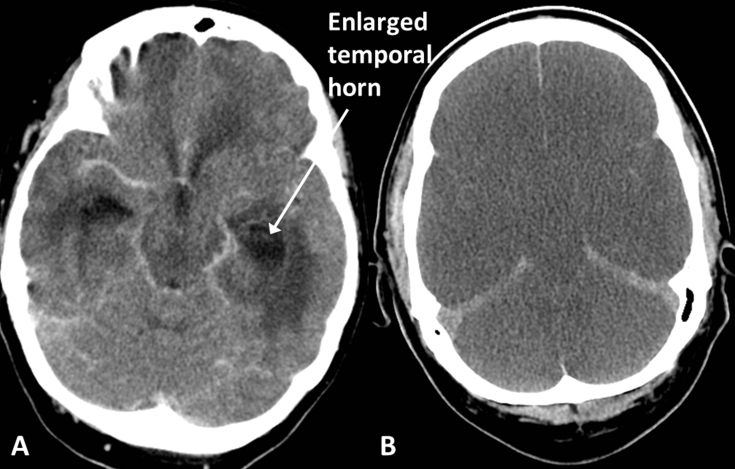 Fig 12