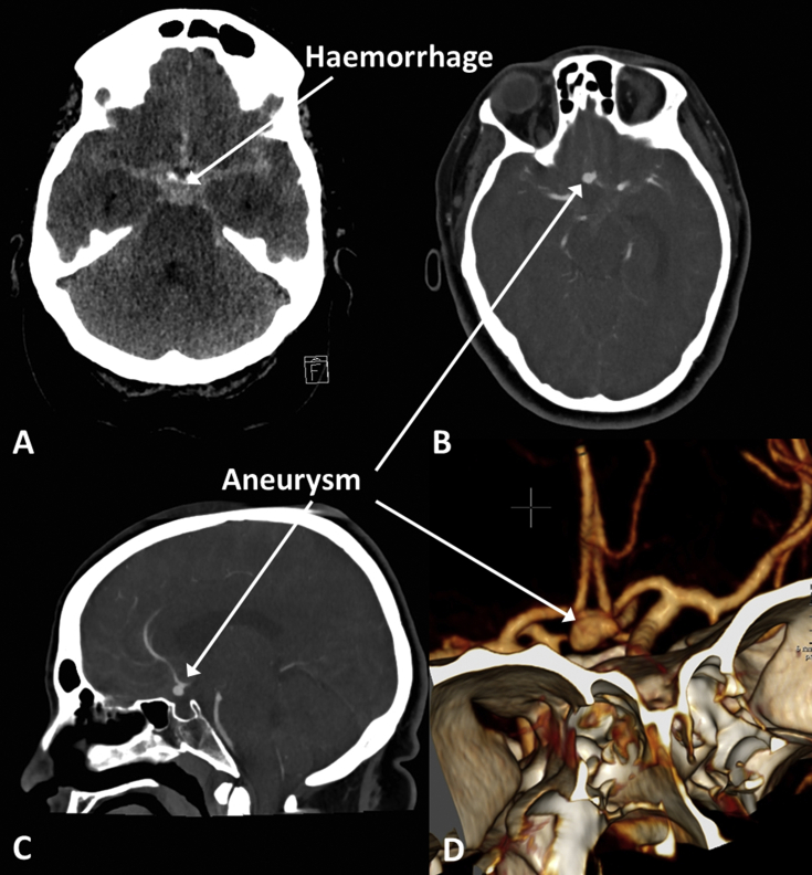 Fig 8