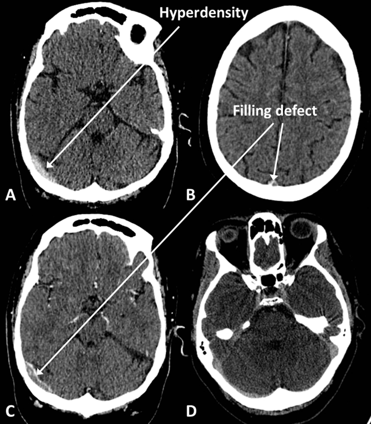 Fig 10