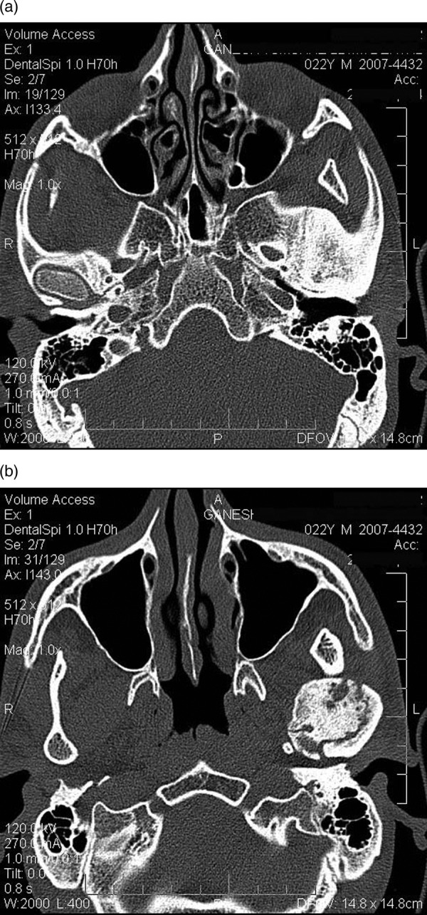 Figure 4