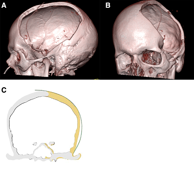 FIG. 1.