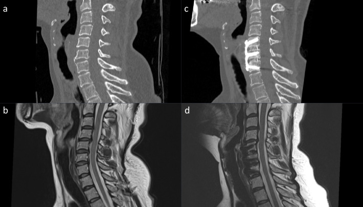 Fig. 2