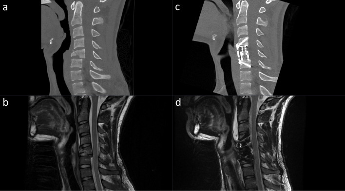 Fig. 1