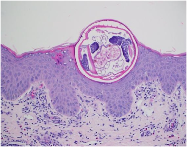 Fig. 2