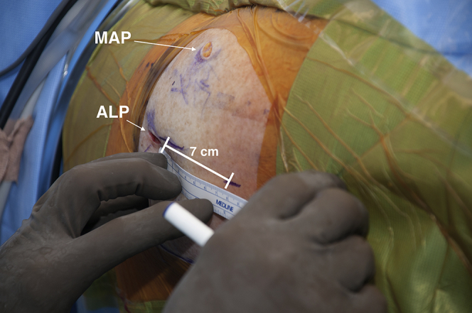 Fig 2