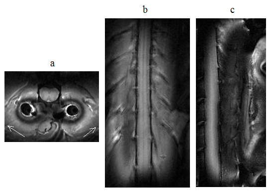 Figure 14