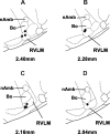 Fig. 10.