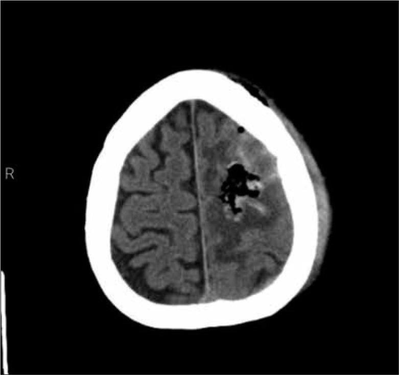 Figure 2: