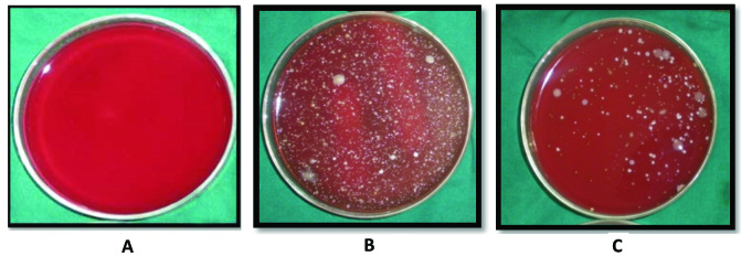 [Table/Fig-15]: