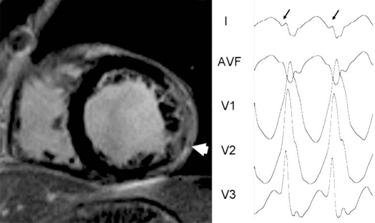 Fig. (4)