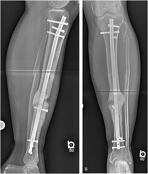 FIGURE 15.