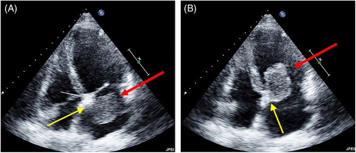 FIGURE 10