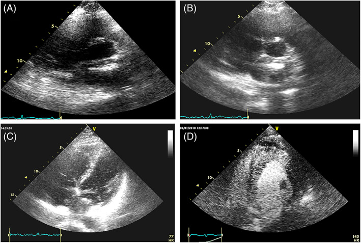 FIGURE 17