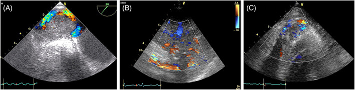 FIGURE 16