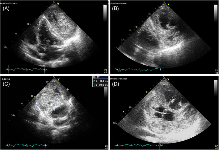 FIGURE 14