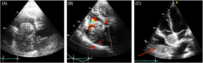 FIGURE 1