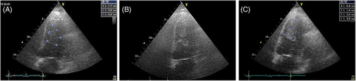 FIGURE 15