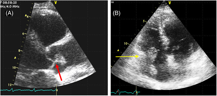 FIGURE 2