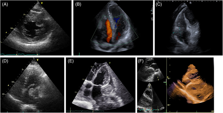 FIGURE 13