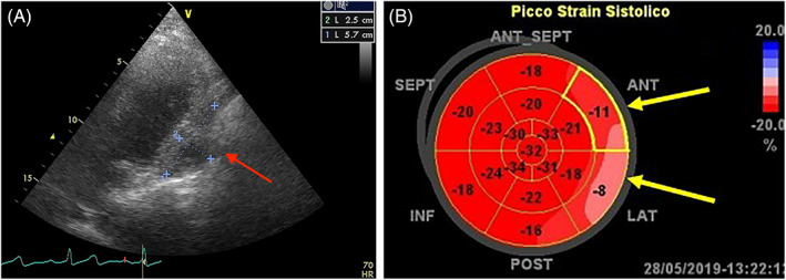 FIGURE 12