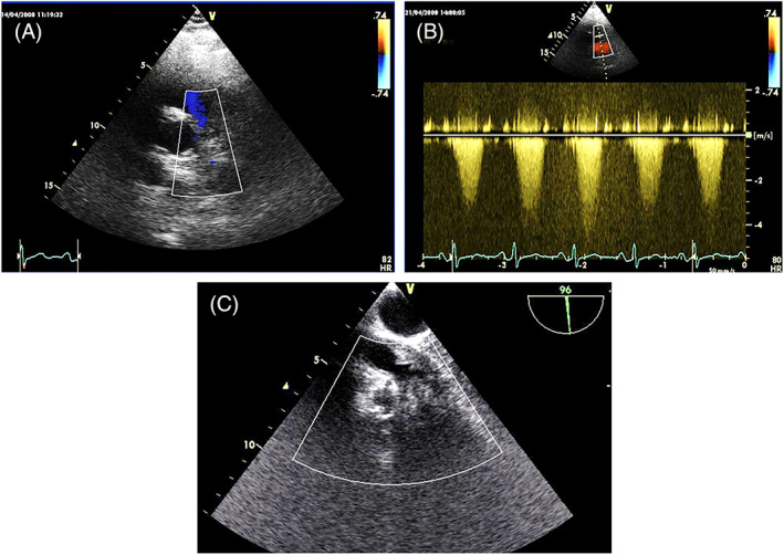 FIGURE 18