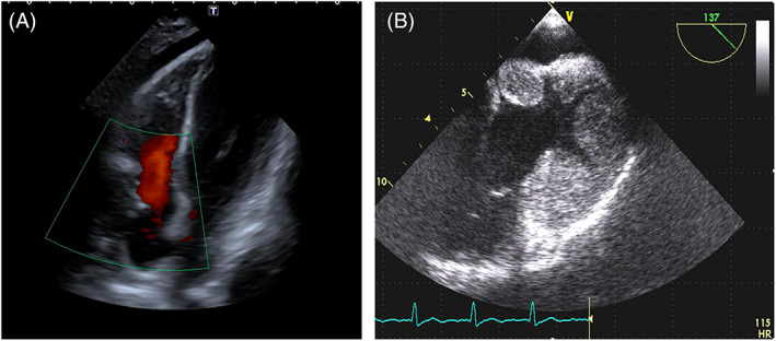 FIGURE 3