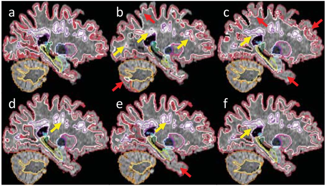 Fig. 3.