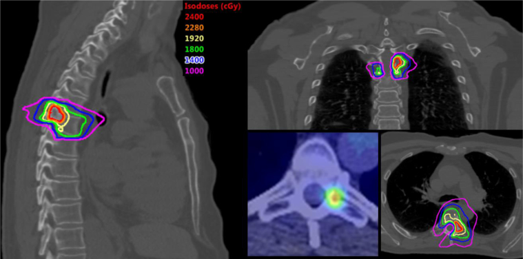 Figure 2