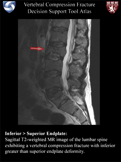 Fig 4