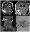 FIG 2