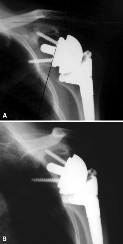 Fig. 3A–B 