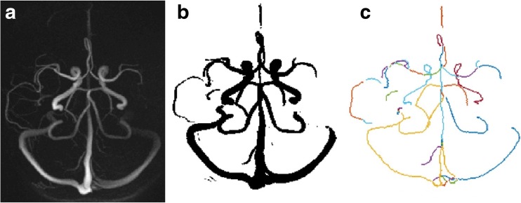 Fig. 1