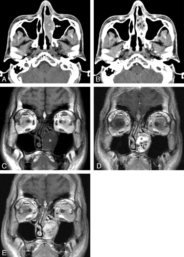 Fig 3.