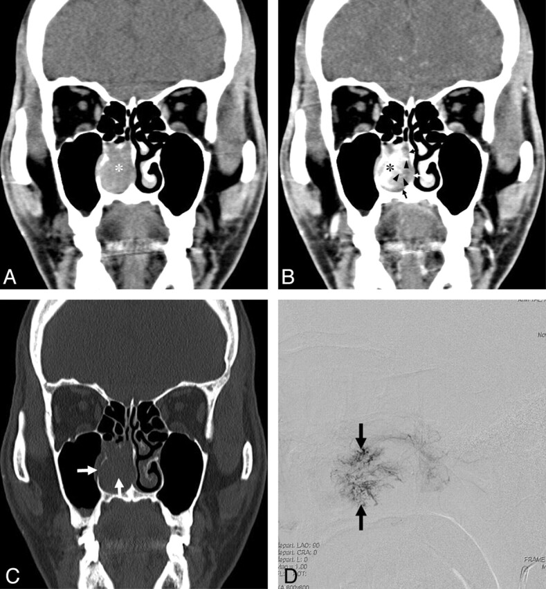 Fig 2.