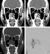 Fig 2.