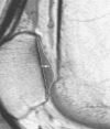 Figure 1a: