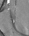 Figure 1d: