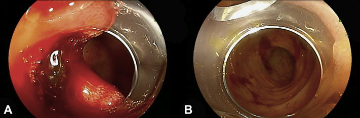 Figure 3
